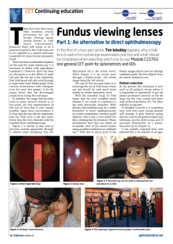 Fundus viewing lenses