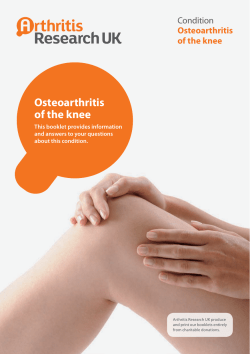 Osteoarthritis of the knee