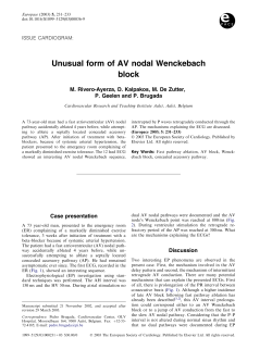 Unusual form of AV nodal Wenckebach block