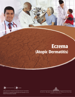Eczema - Frisco Allergy and Asthma Center