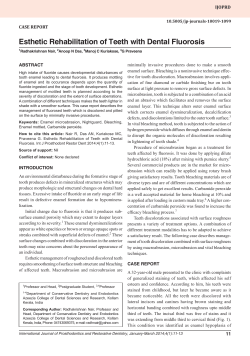 Esthetic Rehabilitation of Teeth with Dental Fluorosis