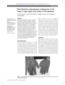 Non-infectious subcutaneous emphysema of the hand