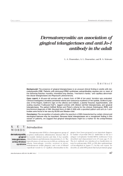 an association of gingival telangiectases and anti Jo-1