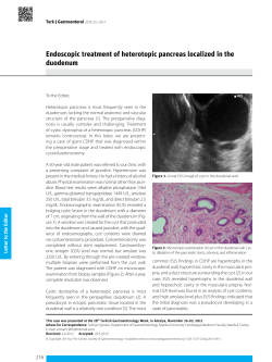 Endoscopic treatment of heterotopic pancreas localized in the
