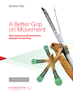 A Better Grip on Movement