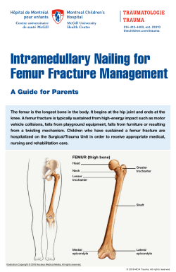Intramedullary Nailing for Femur Fracture Management