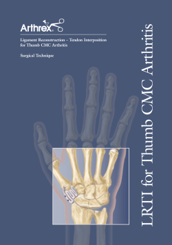 Ligament Reconstruction - Tendon Interposition for Thumb