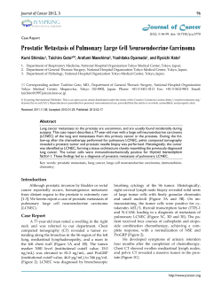 Prostatic Metastasis of Pulmonary Large Cell