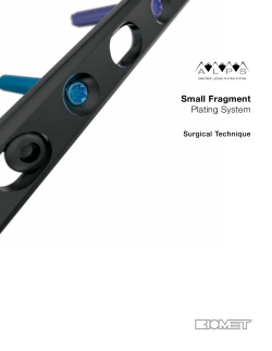 ALPS Small Fragment Plating System - Surgical