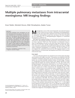Multiple pulmonary metastases from intracranial meningioma: MR
