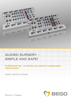 guided surgery &ndash; simple and safe!