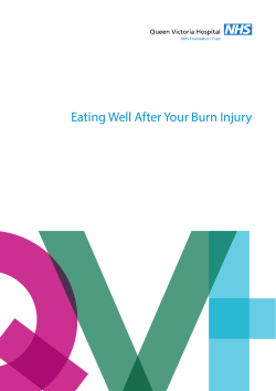 Eating Well After Your Burn Injury
