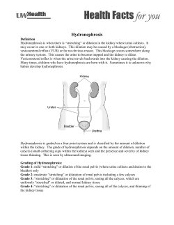Hydronephrosis