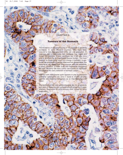 CHAPTER 3 Tumours of the Stomach