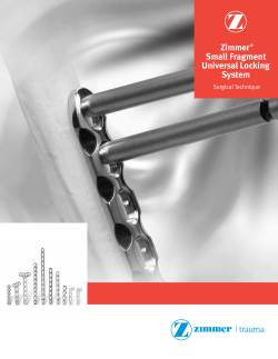 Zimmer&reg; Small Fragment Universal Locking System