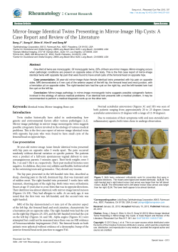 Mirror-Image Identical Twins Presenting in Mirror
