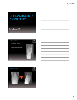 Lis Franc Fractures/Dislocation: What to Fix? When to Fuse?