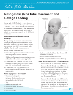 Gavage feeding - Intermountain Healthcare