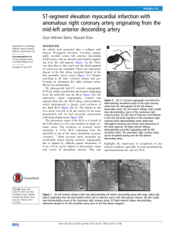 ST-segment elevation myocardial infarction with anomalous right