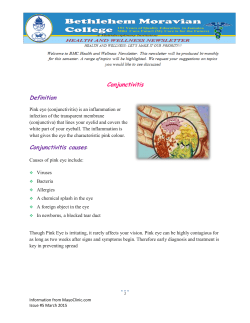 Conjunctivitis 2015