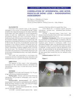radicular bone loss
