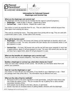 Diaphragm and Cervical Cap - Planned Parenthood of Orange and