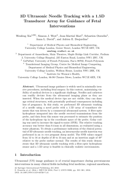 3D Ultrasonic Needle Tracking with a 1.5D Transducer Array for