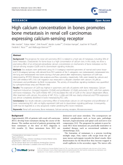 High calcium concentration in bones promotes bone metastasis in