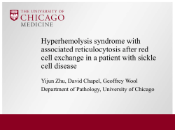 Hyperhemolysis syndrome with associated reticulocytosis