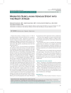 Migrated Subclavian Venous Stent into the Right Atrium