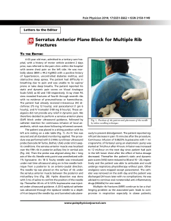 Serratus Anterior Plane Block for Multiple Rib