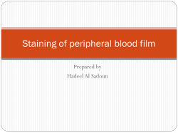 Staining of peripheral blood film