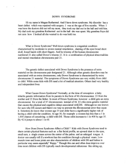 DOWN SYNDROME Hi my name is Megan Rothermel. And I have