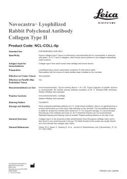 NovocastraTM Lyophilized Rabbit Polyclonal Antibody Collagen