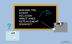 making the right decision about knee replacement surgery
