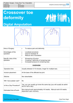 Crossover toe deformity