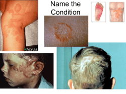 Integumentary Review Slides