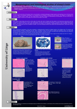 Purkinje cells - ORBi