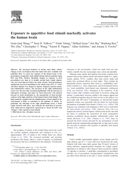 Exposure to appetitive food stimuli markedly