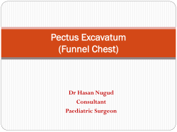 Pectus Excavatum (Pigeon Chest)
