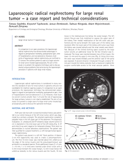 laparoscopic radical nephrectomy for large renal tumor