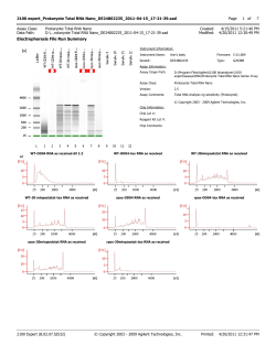 2100 expert_Prokaryote Total RNA Nano_DE24802235_