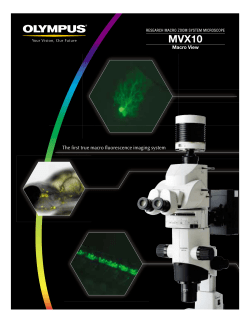 The first true macro fluorescence imaging system