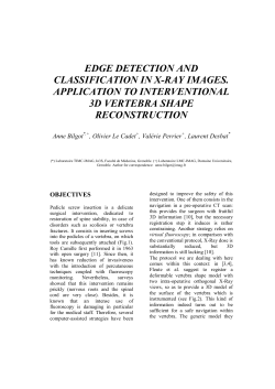 edge detection and classification in x