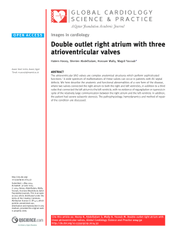 Double outlet right atrium with three atrioventricular valves