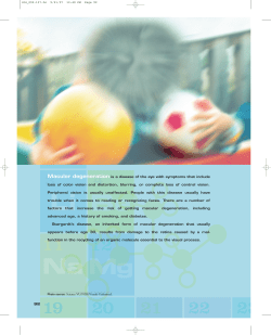 Macular degeneration is a disease of the eye with symptoms