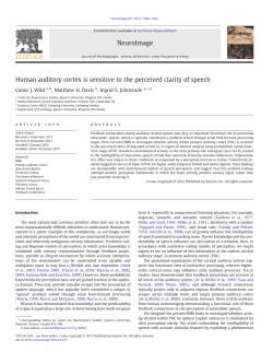Human auditory cortex is sensitive to the perceived clarity of speech