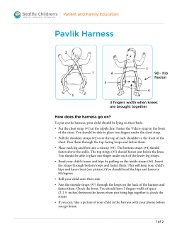 PE409 Pavlik Harness - Seattle Children`s Hospital
