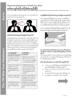 The TB Skin Test (Mantoux) - Minnesota Department of Health