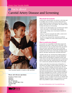 Facts about Carotid Artery Disease and Screening